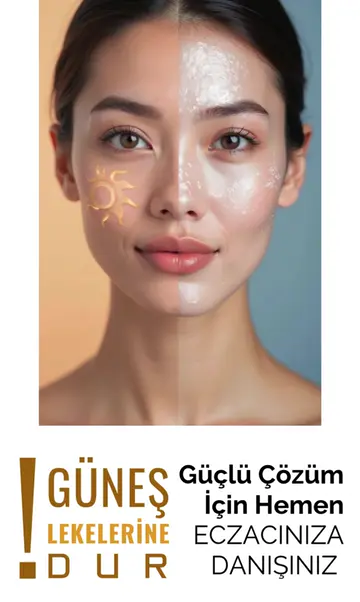 Güneş lekelerine karşı